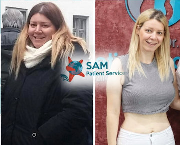 sam patient services | gastric bypass